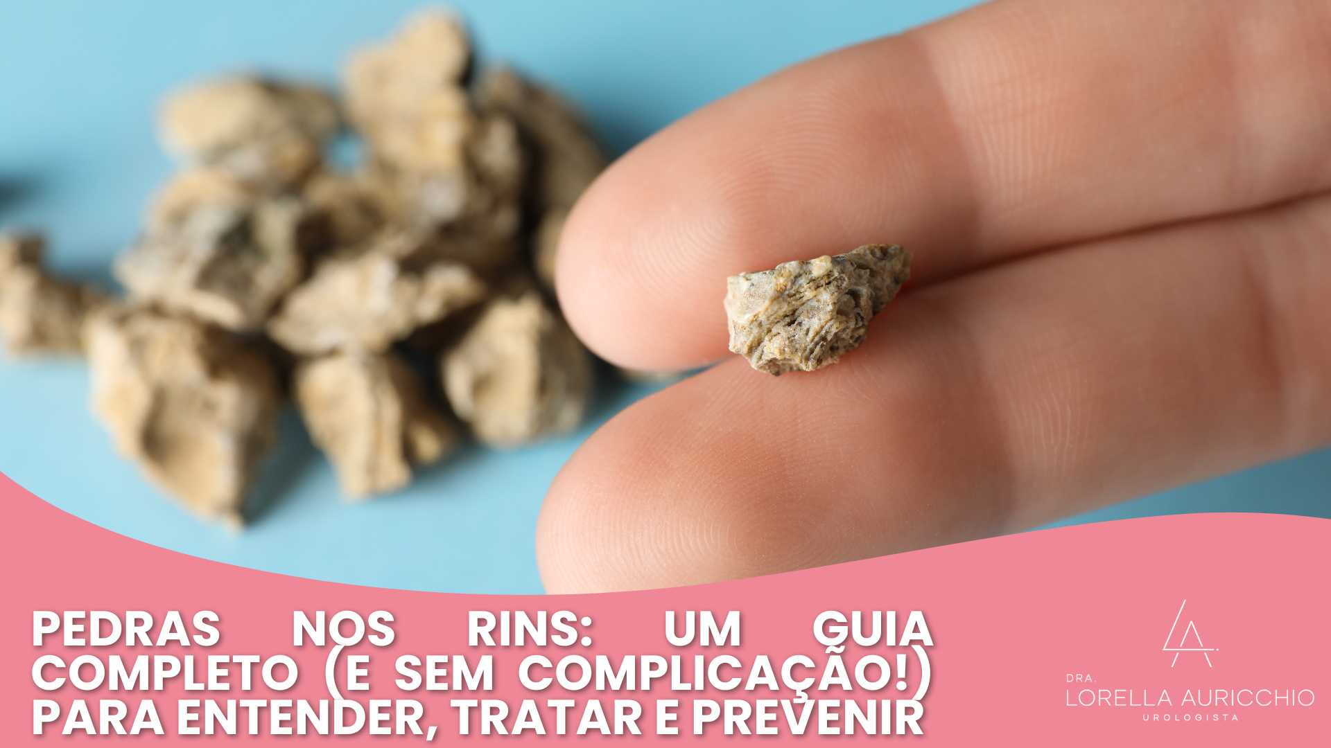 Pedras nos Rins: Um Guia Completo (e sem complicação!) para Entender, Tratar e Prevenir
